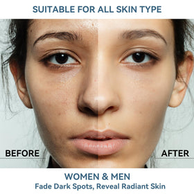 DMYGO dark spot remover application close-up with 360° roller for even distribution.