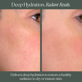 Barrier-support focus with Doctor Rogers Face Cream on clean skin