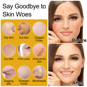 DOYEEWO Skin Care Set 7Pcs toner bottle highlights refreshing hydration for balanced skin.