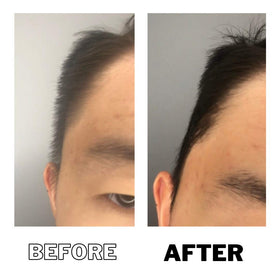DPERM before and after hair shows potential transformation