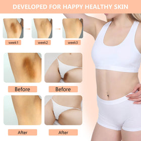 Hands applying DR.Afanyr skin bleaching cream to the skin