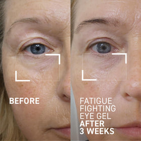 Dr. Brandt iD-STRESS eye gel cools the eye area to refresh tired-looking skin.