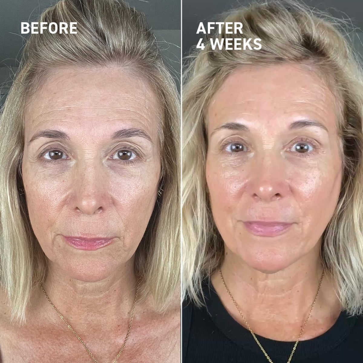 Dr. Brandt Needles No More dispensing scene highlighting easy nightly application