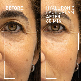 Dr. Brandt Needles No More Hyaluronic Face Cream application swatch demonstrating creamy texture.