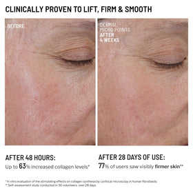 Dr. Brandt Needles No More pairing with Hydro Biotic Sleeping Mask for barrier balance