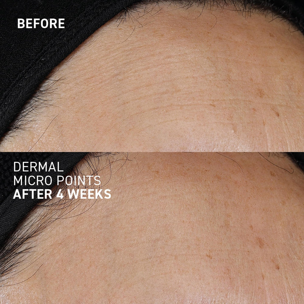 Dr. Brandt Needles No More box and jar packaging highlighting premium skincare