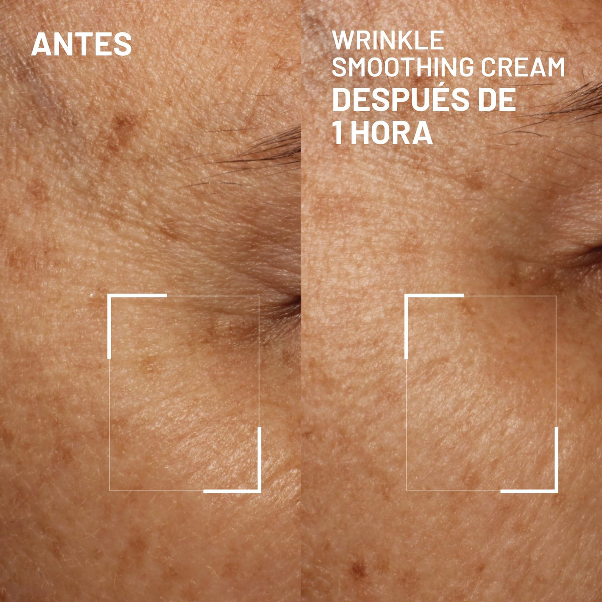 Forehead lines treatment with Dr. Brandt Needles No More Wrinkle Smoothing Cream.