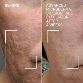 Dr. Brandt Skincare exfoliator applied on damp skin for even texture.