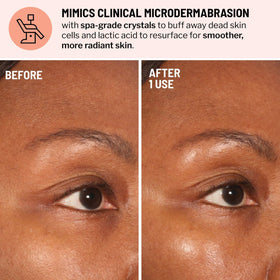 Dr. Brandt exfoliator crystal close-up showing gentle resurfacing action.