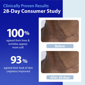 Dr. Denese Neck Serum Roll-On closeup-texture reveals smooth, hydrated skin