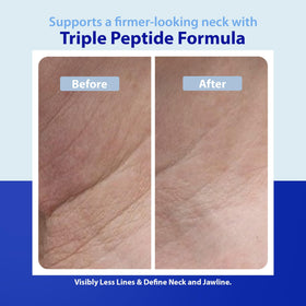 Dr. Denese peptide and hyaluronic acid blend delivers hydrating skin support.