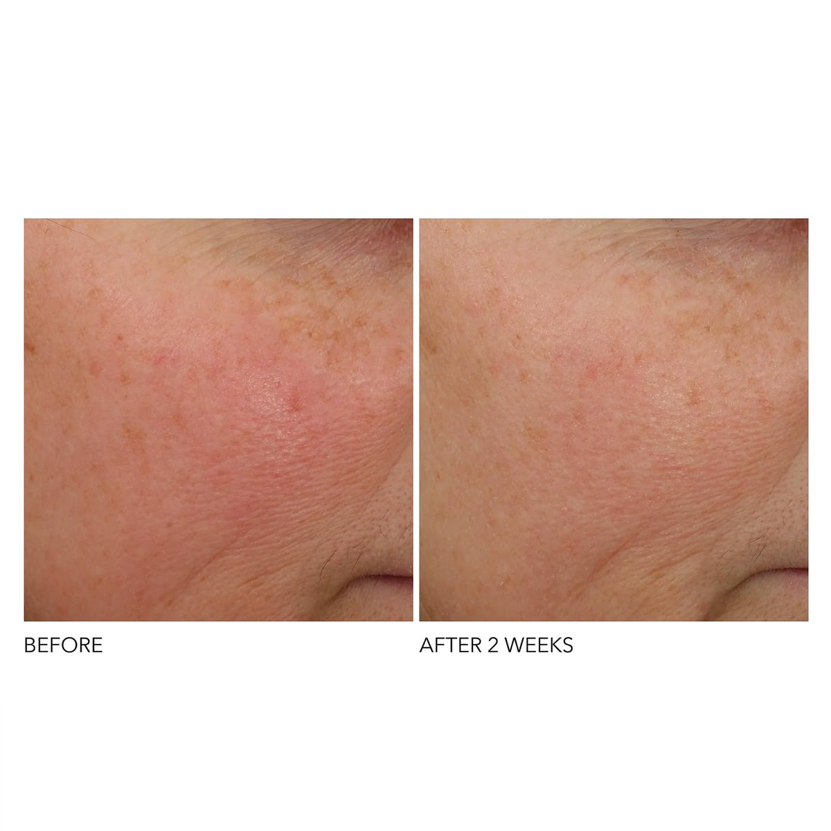 Dr Dennis Gross Advanced Retinol Ferulic Overnight rambutan ingredient detail
