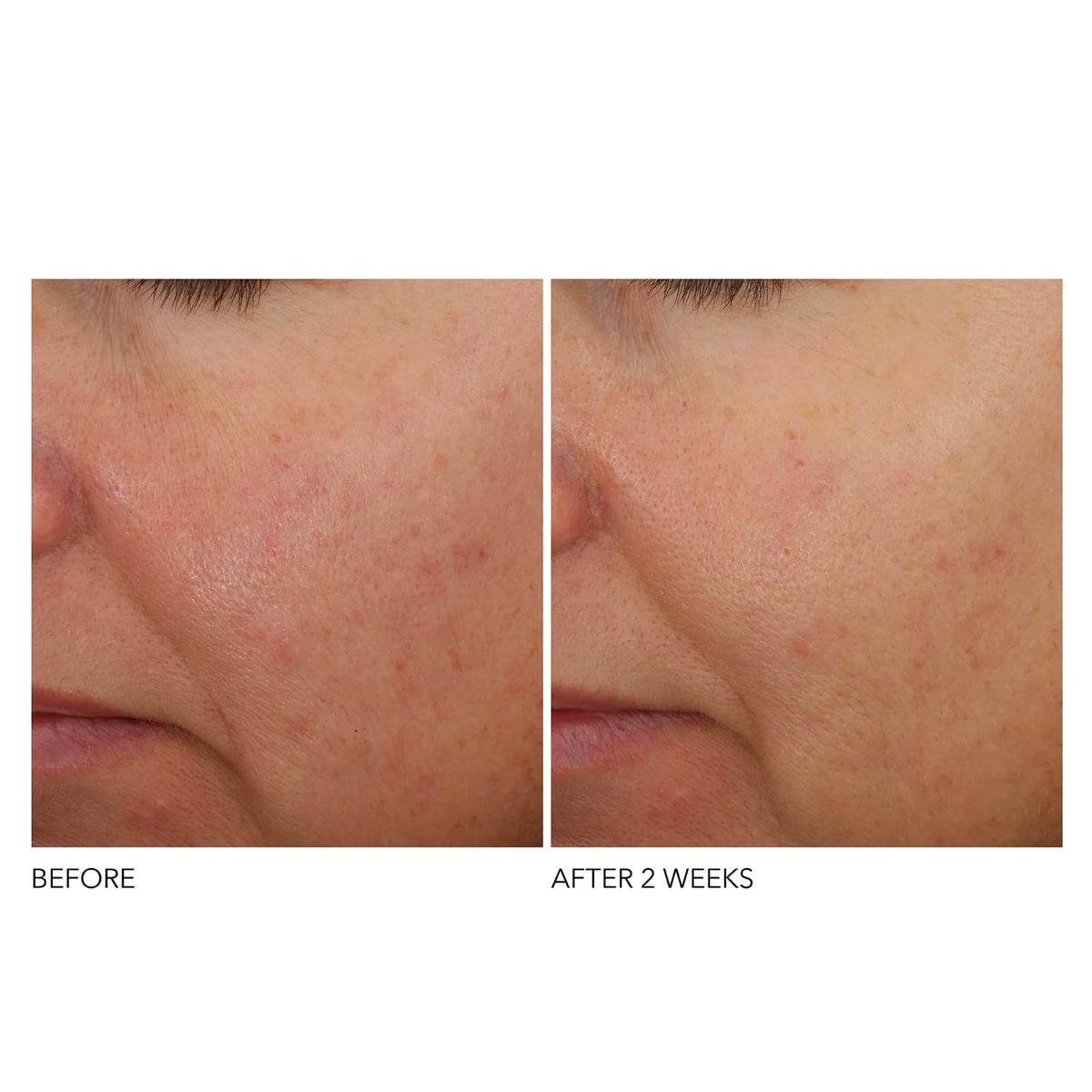 Dr Dennis Gross Advanced Retinol Ferulic Overnight vegan cruelty-free badge visible