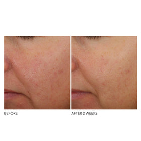 Dr Dennis Gross Advanced Retinol Ferulic Overnight vegan cruelty-free badge visible