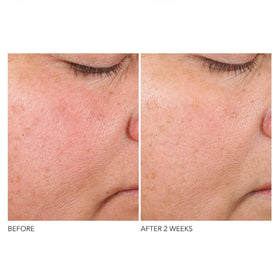 Dr Dennis Gross label detail highlights Phyto-Retinol Blend and botanicals for renewal.