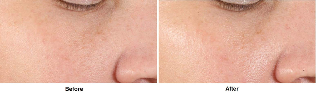 Closeup of serum texture from Dr Dennis Gross Alpha Beta Pore product.