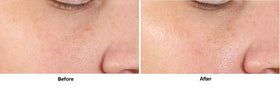 Closeup of serum texture from Dr Dennis Gross Alpha Beta Pore product.
