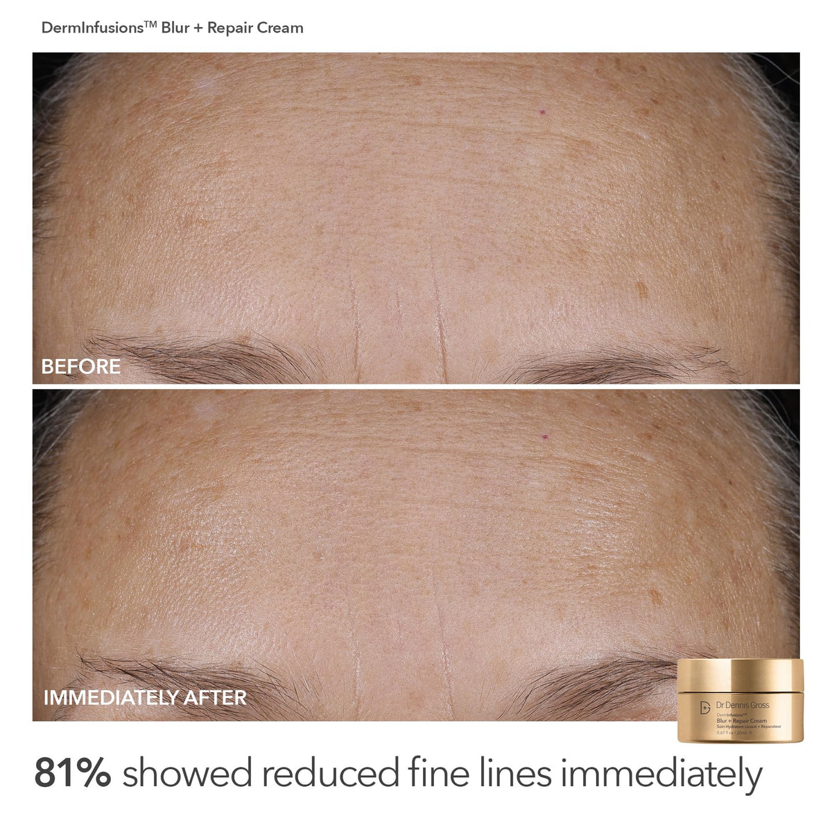 Dr Dennis Gross Alpha Beta Universal Daily Peels packets for at-home exfoliation.