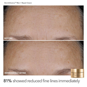 Dr Dennis Gross Alpha Beta Universal Daily Peels packets for at-home exfoliation.