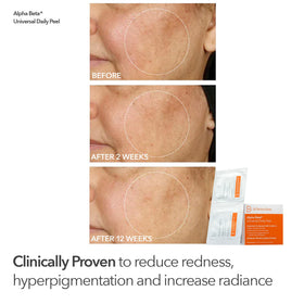 Dr Dennis Gross DermInfusions Blur + Repair Cream tube delivering hydration and a soft finish.
