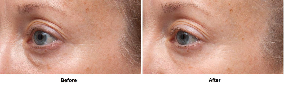 Dr Dennis Gross Ferulic + Retinol Eye Serum eyelid texture focus may reduce crepiness