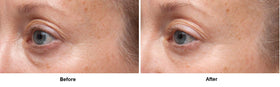Dr Dennis Gross Ferulic + Retinol Eye Serum eyelid texture focus may reduce crepiness