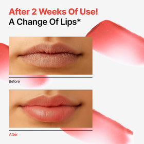 Dr.Different retinal lip balm on lips reveals natural tint and cushion texture.