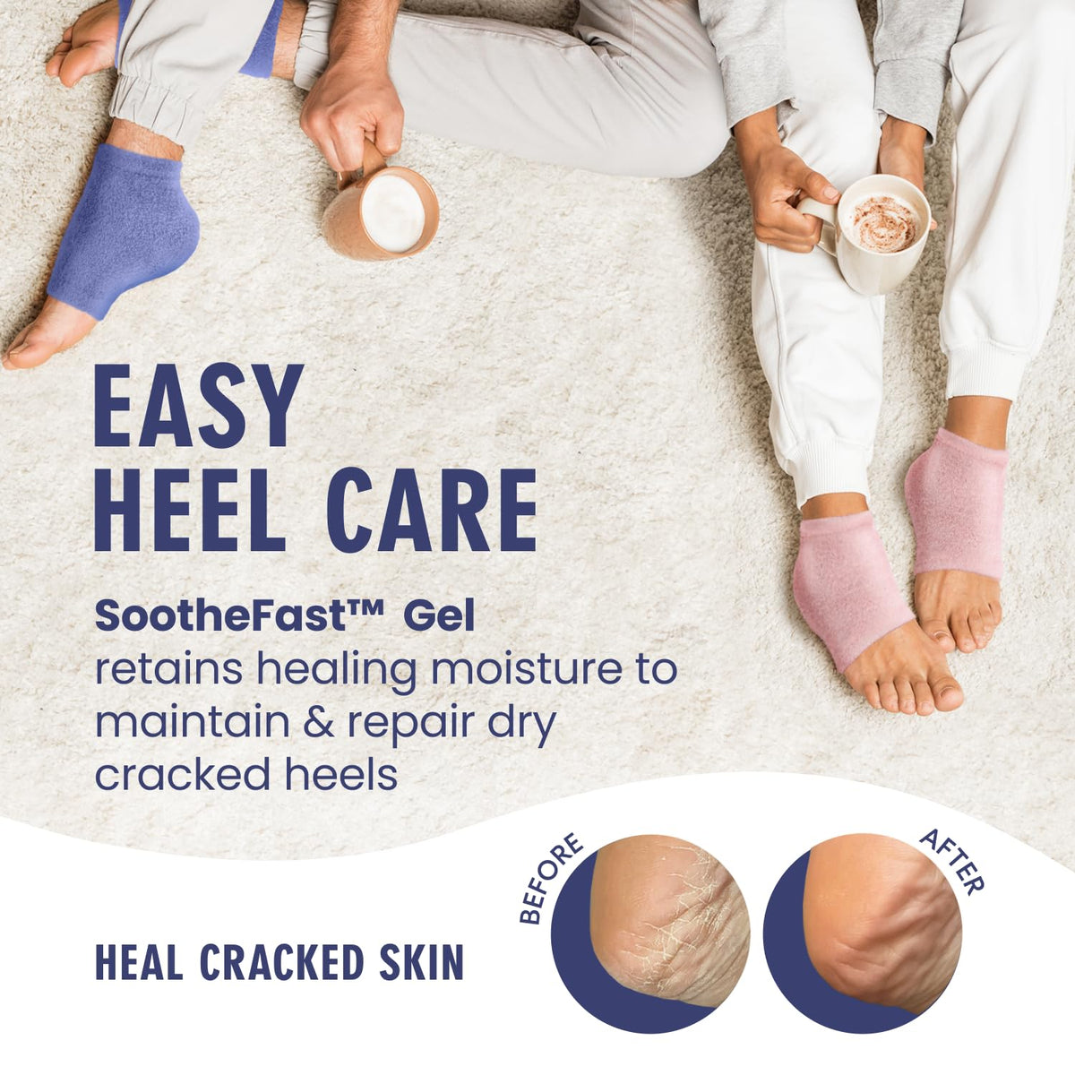 Dr. Frederick's Original fuzzy heel socks worn on feet for warm, overnight hydration potential.