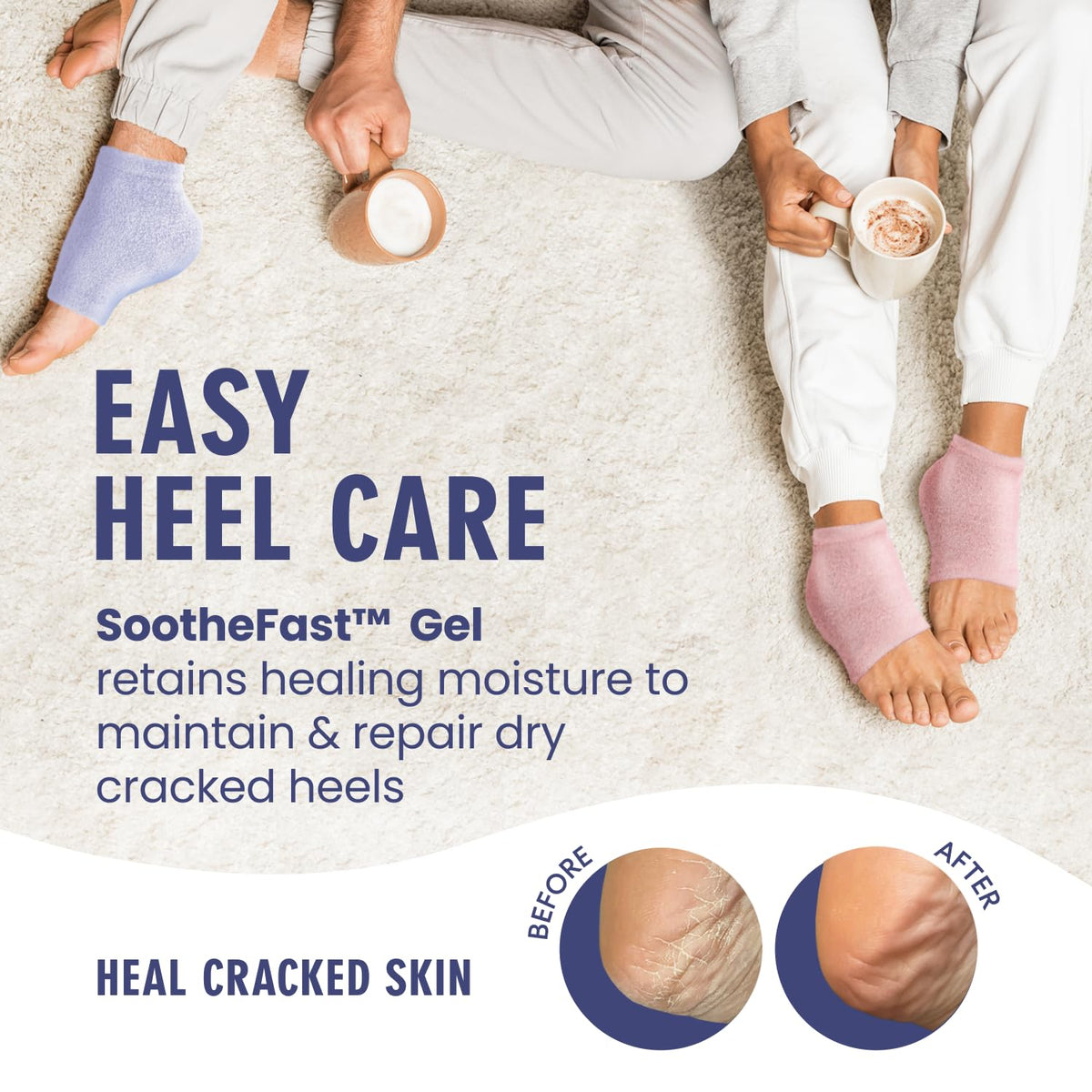 Overnight wear on bed shows softening effects on dry heels.