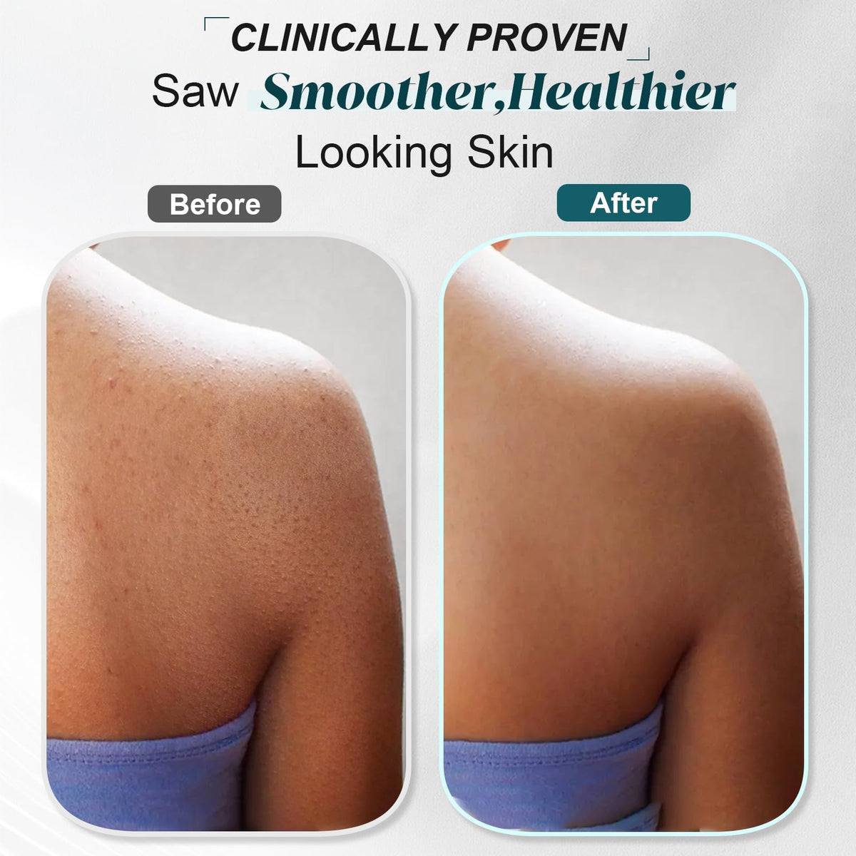 Dr. Valendre Sea Salt Scrub underarms refreshes and supports even tone.