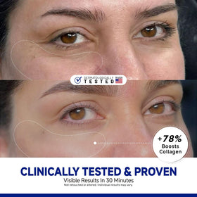 Dr Vincent Peptide Under Eye Patches applied to under-eye area for soothing use