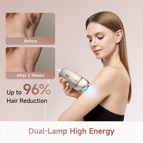 DREAME Nova IPL with 27J high-energy output for deeper follicle reach.