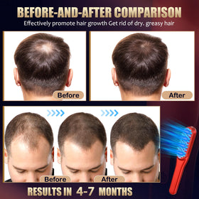 DREWALA Laser Hair Growth Comb with red LED illumination supports at‑home sessions.