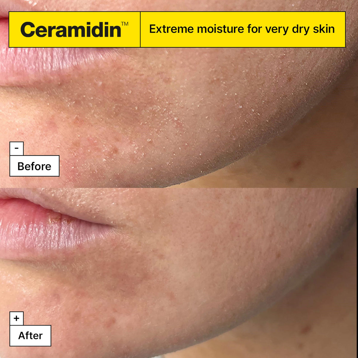 Ingredients focus on ceramides and ectoin in Dr.Jart+ cream