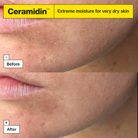 Ingredients focus on ceramides and ectoin in Dr.Jart+ cream