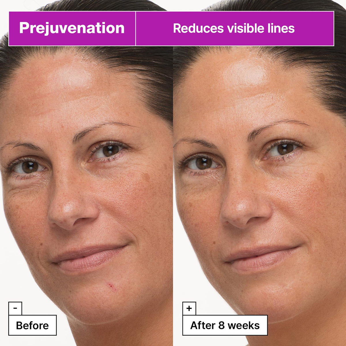 Packaging shot highlights barrier-support ingredients for sensitive skin.