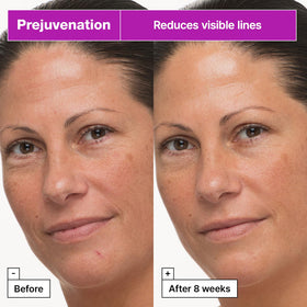 Packaging shot highlights barrier-support ingredients for sensitive skin.