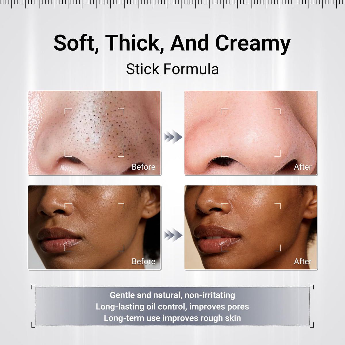 Dr.Leo Kaolin Charcoal Mask pore-minimization and shine reduction