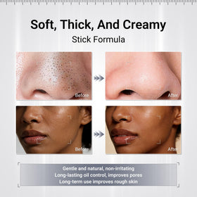 Dr.Leo Kaolin Charcoal Mask pore-minimization and shine reduction