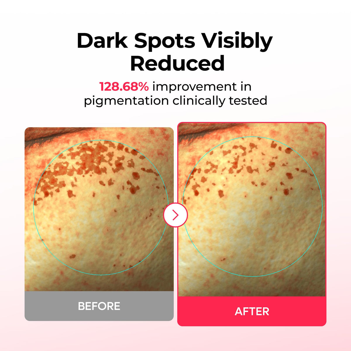 Dr.Melaxin TX cooling hydrogel layer provides soothing coverage on skin.