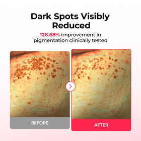 Dr.Melaxin TX cooling hydrogel layer provides soothing coverage on skin.
