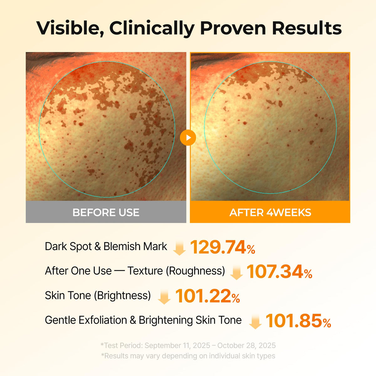 Closeup of Dr.Melaxin TX Kojic Toner Pads ingredients label for skin care