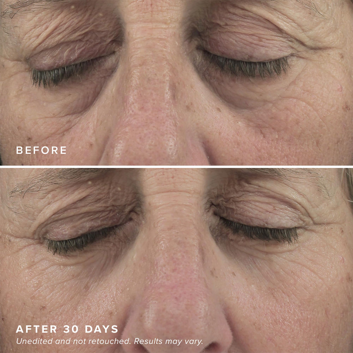 DRMTLGY niacinamide formula targeting dark circles and brightness.