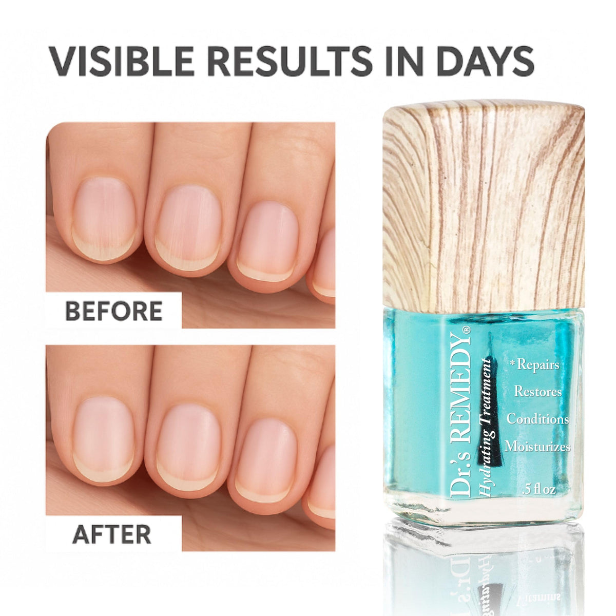 Dr.'s Remedy Total Two-in-One packaging highlighting multipurpose nail care.