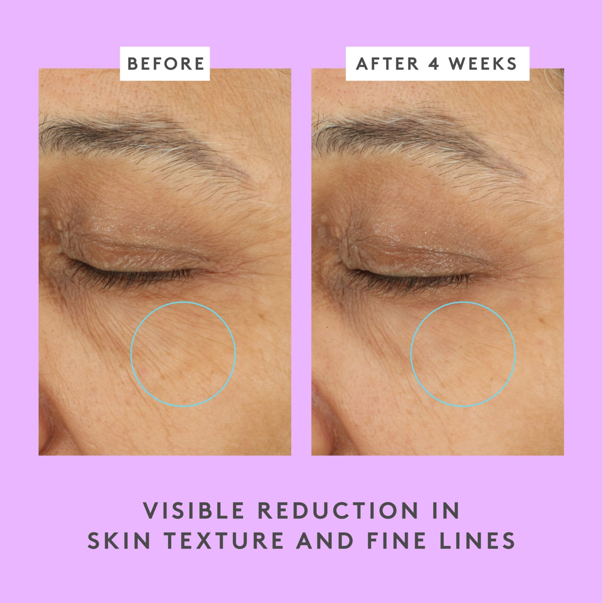 Drunk Elephant Ceramighty AF Eye Balm applied under-eye for soothing, hydrated look.