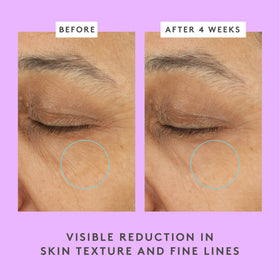 Drunk Elephant Ceramighty AF Eye Balm applied under-eye for soothing, hydrated look.