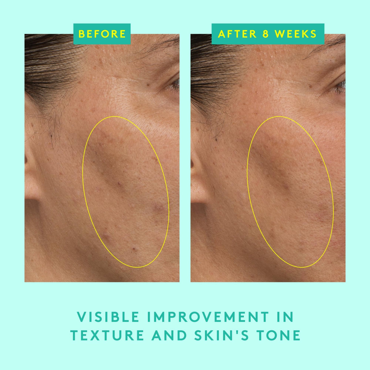 Label highlights 10% lactic acid and peptide complex