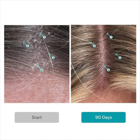 Close-up of Dandrene shampoo lather on hair for smoothness.