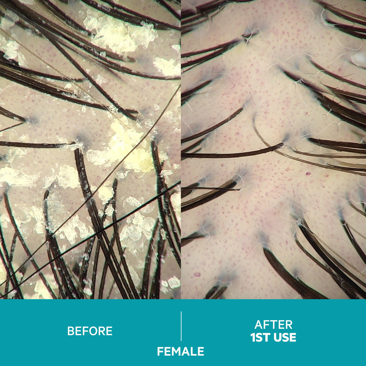 DS Labs Dandrene close-up on dry hair post-use for softer strands.