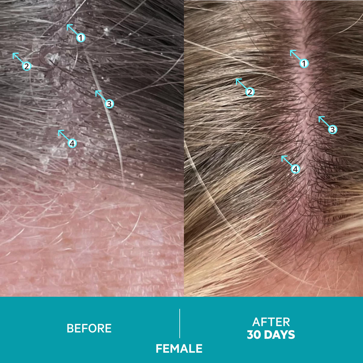 DS Labs Dandrene packaging box communicates dermatologist-backed care.